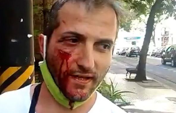 brutal agresión a un vigilador por parte de una patota del bloque nacional de la seguridad privada